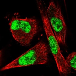 VEZF1 Antibody, Novus Biologicals 0.1mL; Unlabeled:Antibodies, Polyclonal